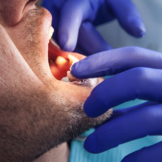 Why Are Oral Cancer Screenings So Important?